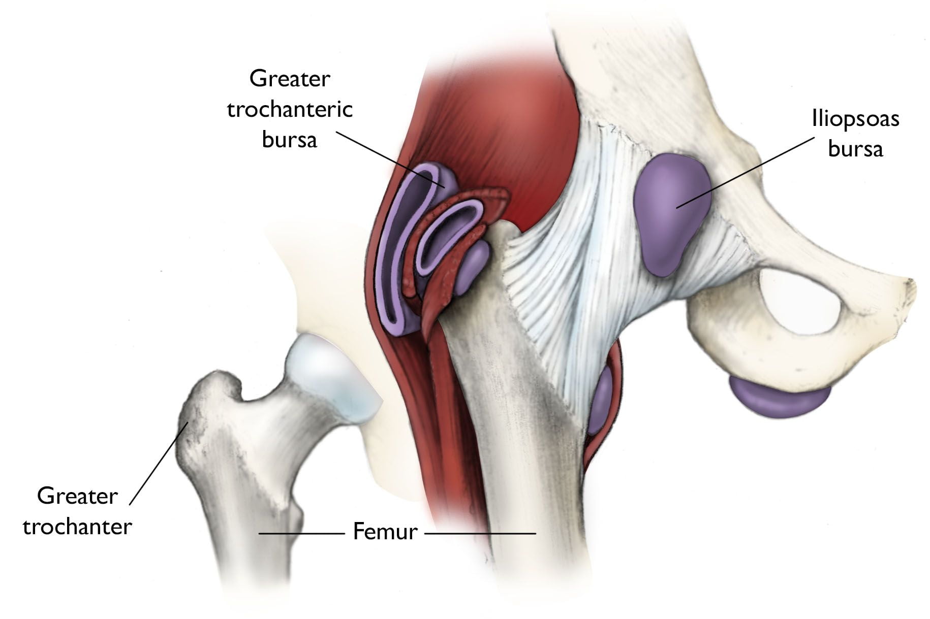 Iliopsoas Bursitis And Iliopsoas Bursitis Treatment Methods