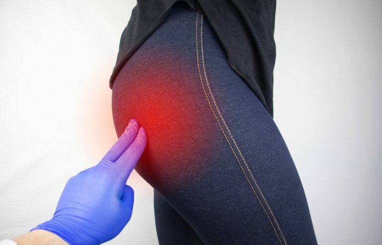 Gluteal Tendinopathy How It Feels Causes And Tips To Help