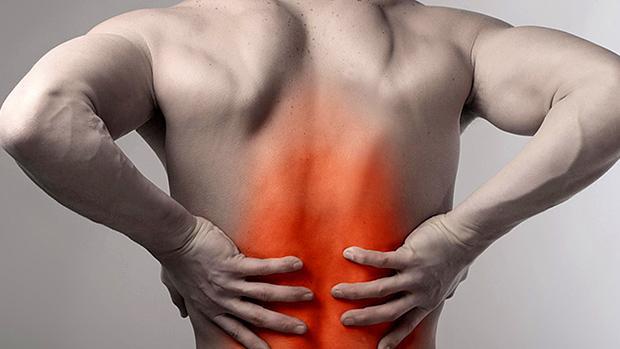 Back sprain