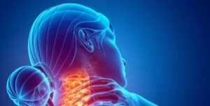 Cervical Myelopathy