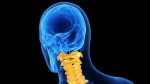 What Are Some Different Cervical Spine Problems?