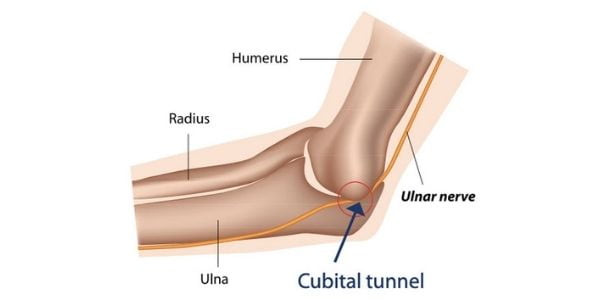 Understanding and Managing Elbow Nerve Pain: A Comprehensive Guide