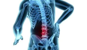 What Does Mechanical Back Pain Mean?
