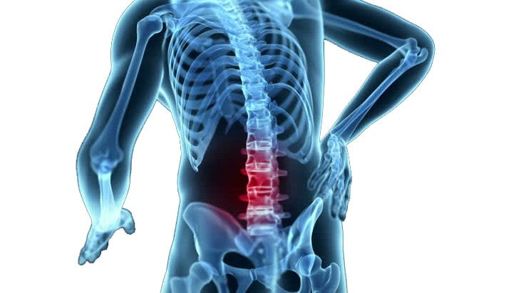 Mechanical Back Pain Causes Treatment And Exercises To Help