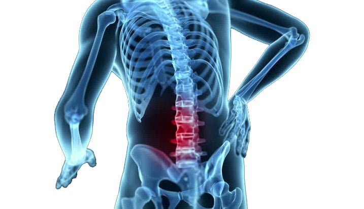 mechanical-back-pain-causes-treatment-and-exercises-to-help