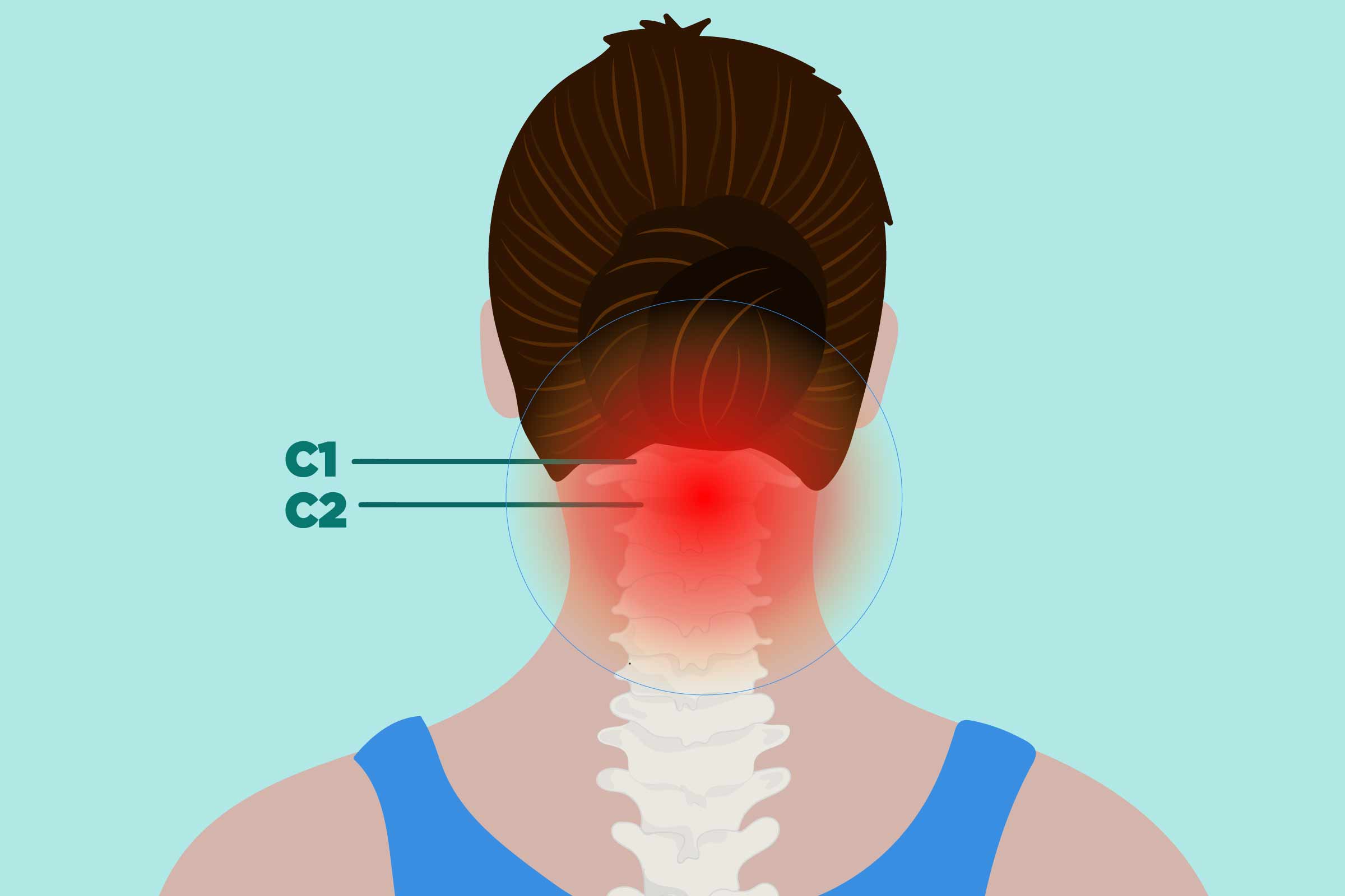 Rheumatoid Arthritis And Cervical Spine: Treatment And More