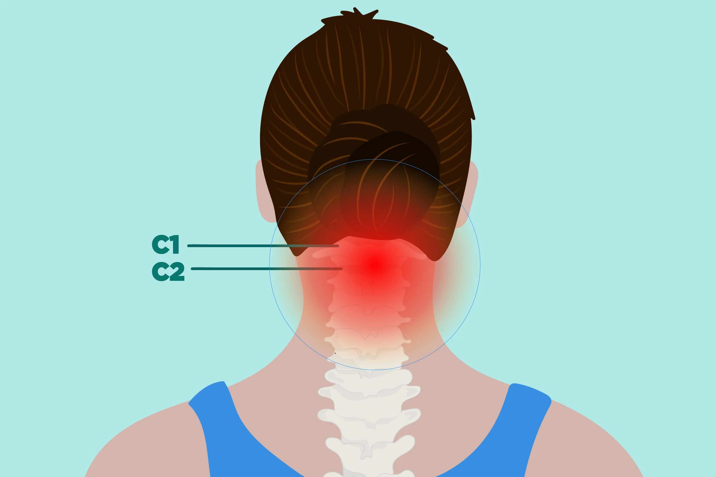Navigating the Intersection of Rheumatoid Arthritis and Cervical Spine Health