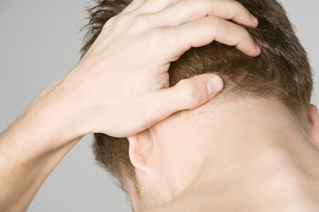 Pain in the Back of the Head
