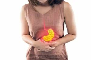 Preventing Acid Reflux in Pregnancy