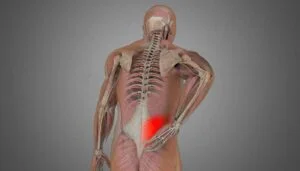 Preventive Strategies for Lower Back Injuries