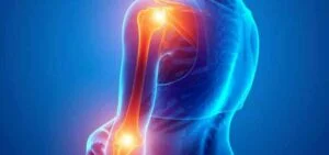 What Can Help With Pain From Shoulder To Elbow?