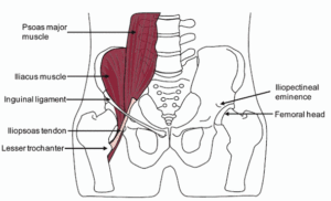 Iliacus Muscle Pain: Signs, Causes and Treatment