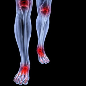 The Link Between Knee and Ankle Pain