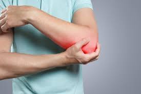 The Link Between Lupus and Elbow Pain