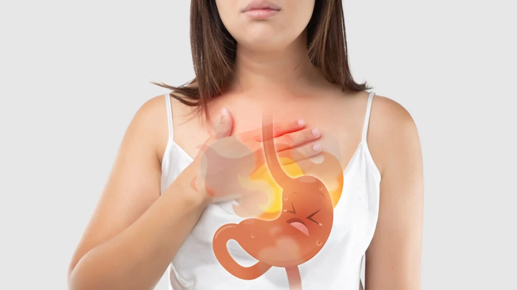 Treating Acid Reflux