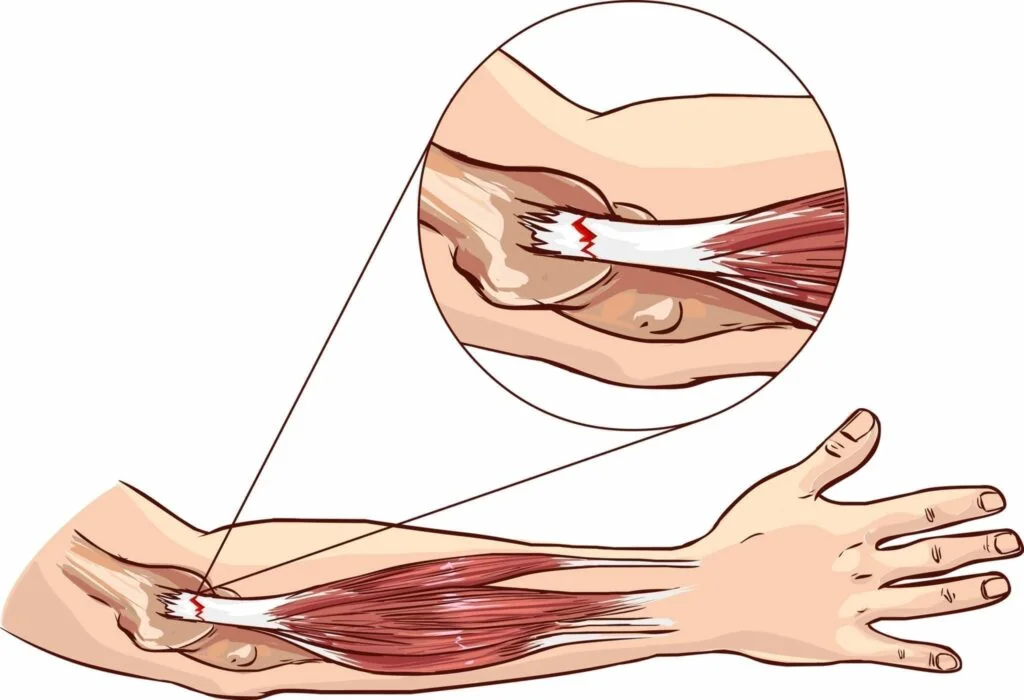 Treatment Options