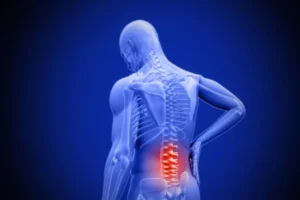 Understanding Back Sprain
