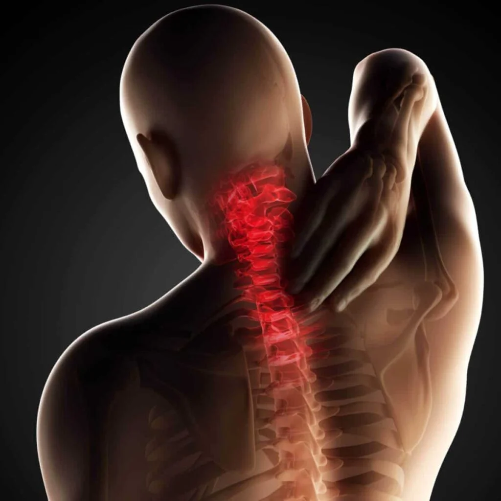 Understanding Upper Back Spasms: Causes and Treatment