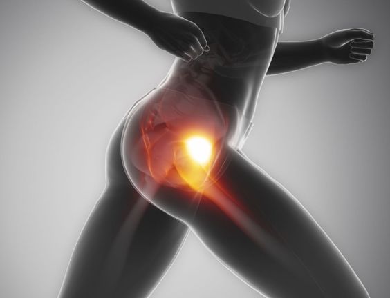 Understanding and Managing Psoas Syndrome