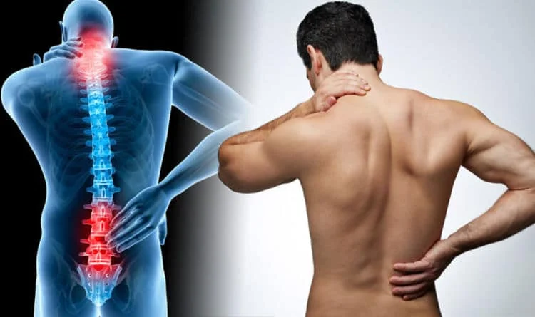 Complexity of Fibromyalgia-Induced Back Pain: A Comprehensive Guide