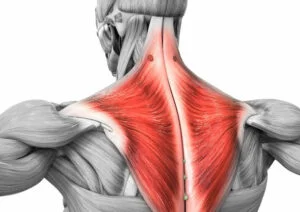 What Is Trapezius Muscle Strain?