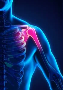 Diagnosis of Bilateral Shoulder Pain