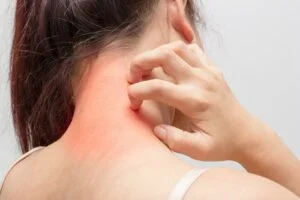 What Are Some Tips For Stiff Neck Relief?