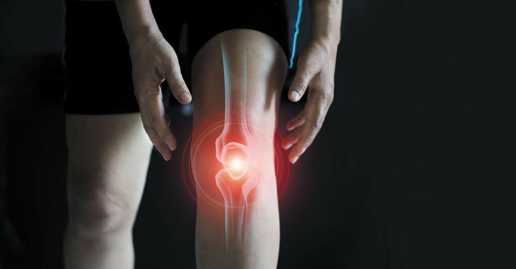 Conquering Knee Pain: Understanding Causes, Treatments, and Prevention
