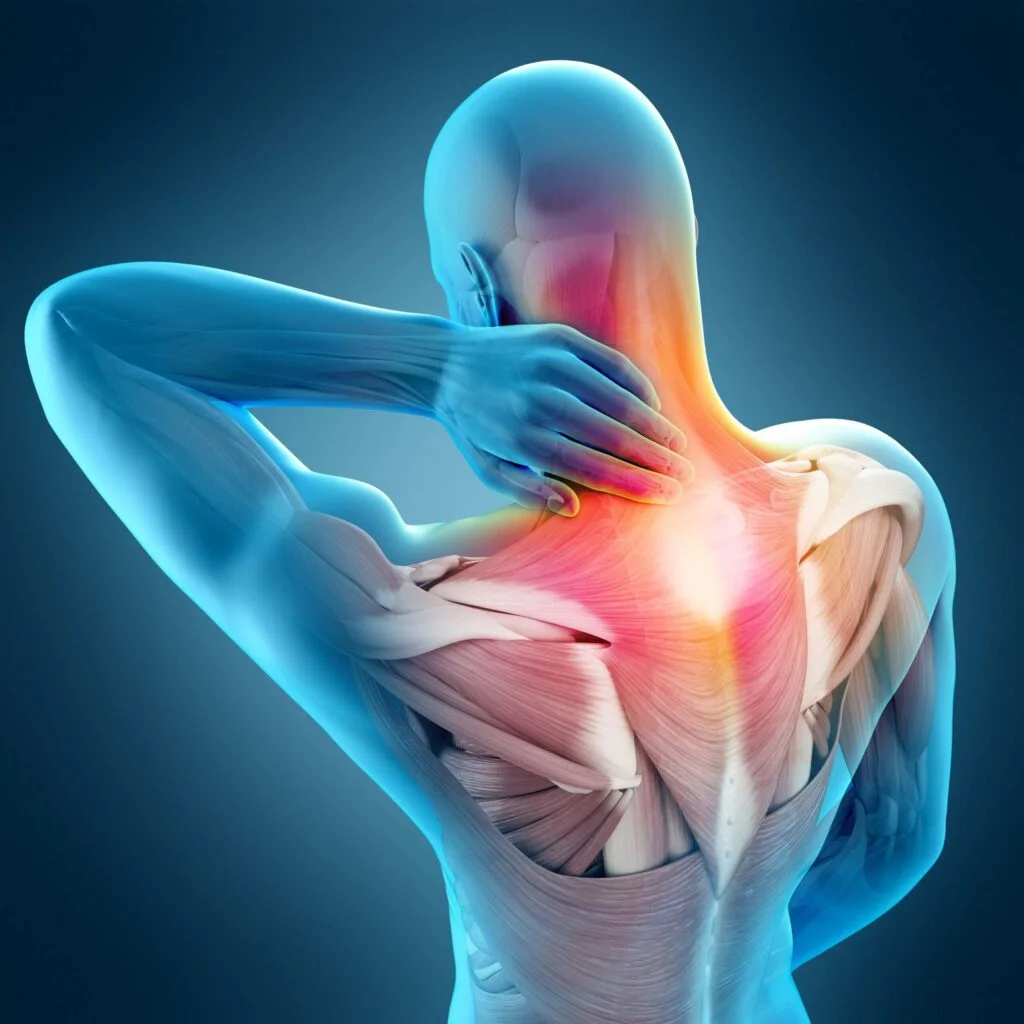 Muscle Tightness in Neck: Signs, Causes and Treatment Methods
