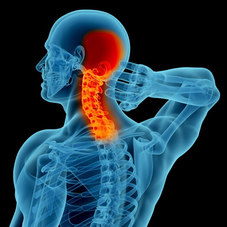 Neck Tendonitis: Signs, Caues and Treatment Methods