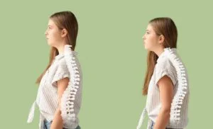 Causes of Musculoskeletal Back Pain