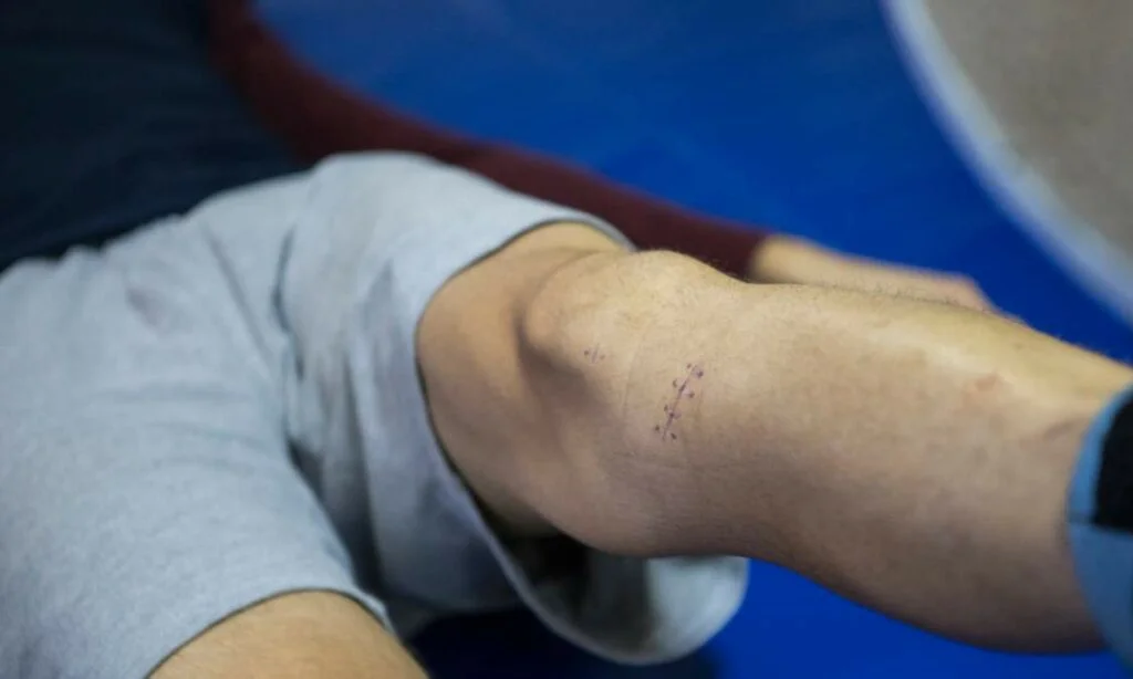 Common Causes Behind Knee Pain While Walking