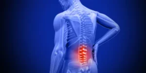 Common Causes of Axial Back Pain