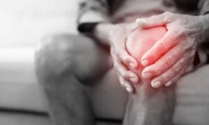 Common Causes of Stiffness in the Knee-Osteoarthritis