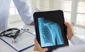 Diagnosing Frozen Shoulder