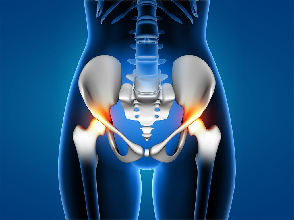 Hip And Groin Pain: Causes, Exercises And Stretches To Help