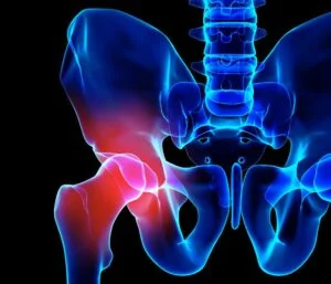 What Pain Is Normal After Hip Replacement?
