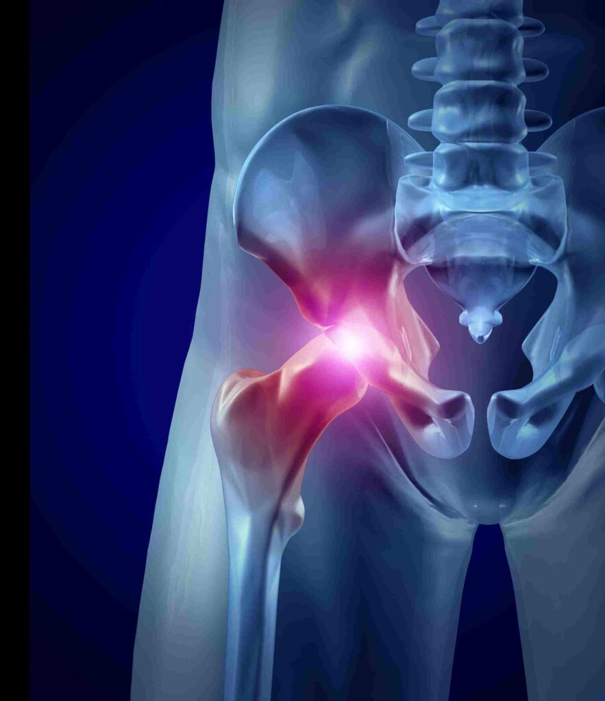 The Anatomy of Hip Ligament Injury: What You Need to Know