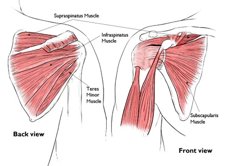 Infraspinatus Pain