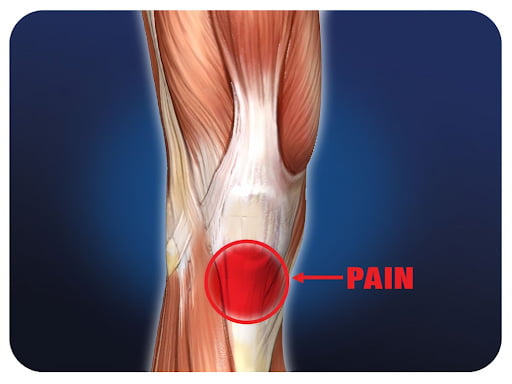 Jumper's Knee: Signs, Causes and Treatment Methods