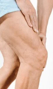 Knee Pain Due To Tight Muscles and Imbalance