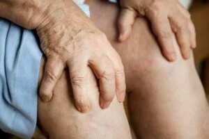 Management and Treatment Options