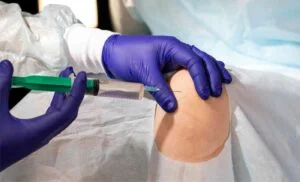Medical Treatments for Patellofemoral Pain Syndrome (PFPS)