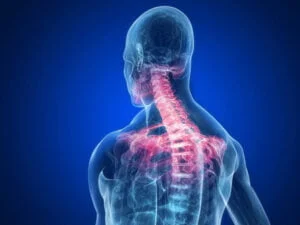 Neck Pain When Looking Down