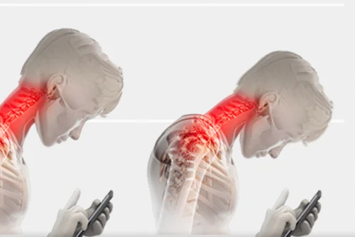 Neck Pain When Looking Down