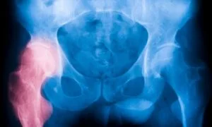 Physical Changes That Can Cause Hip Pain During Pregnancy