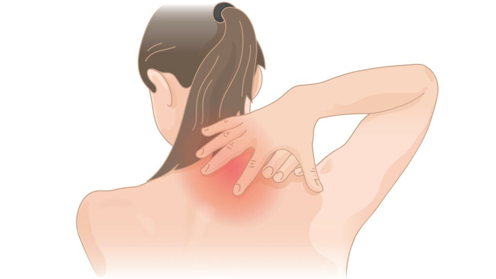 Pinched Shoulder Nerves: Causes and Treatment