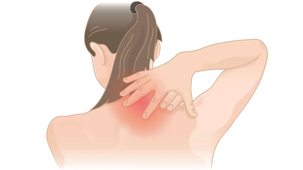 Pinched Shoulder Nerves: Causes and Treatment