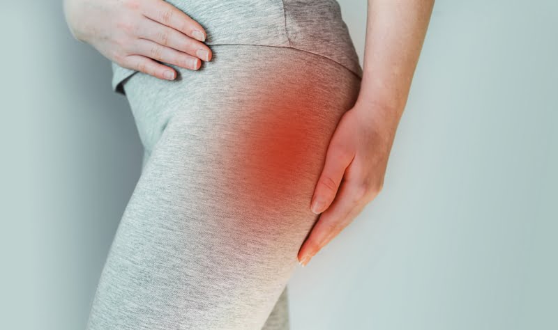 Piriformis Hip Pain: Understanding, Treatment, and Prevention