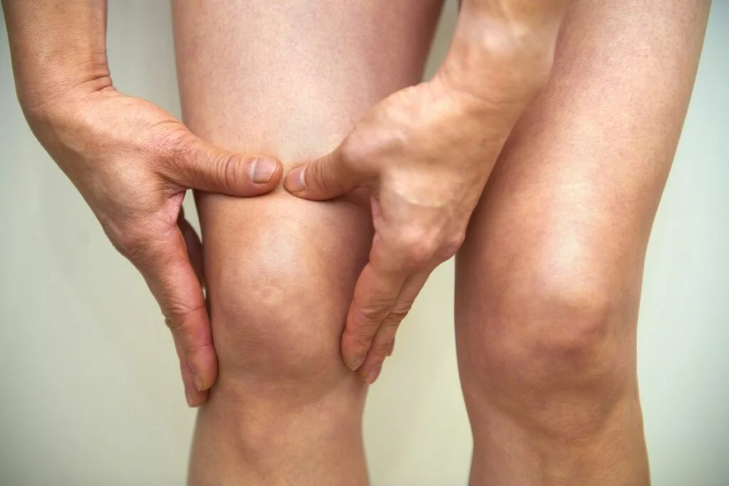 Psoriatic Arthritis